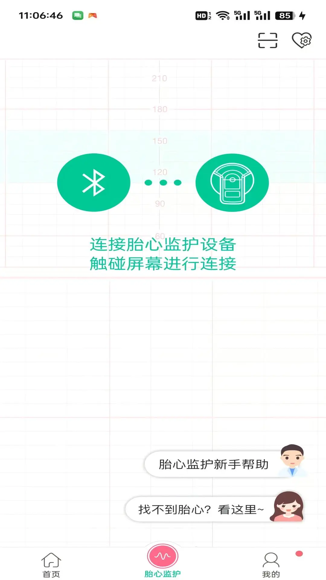 微胎心截图