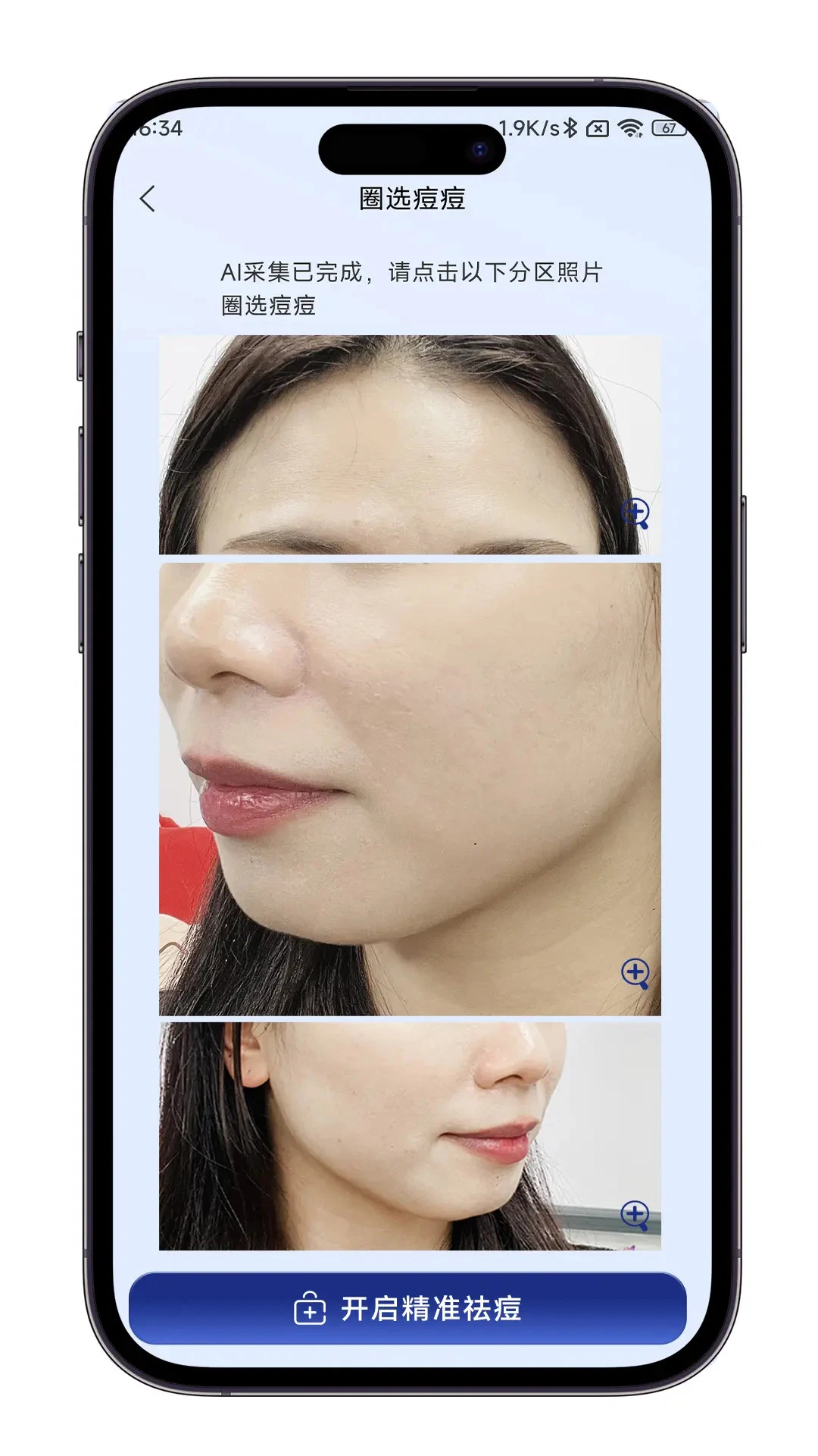 AI皮肤管家截图