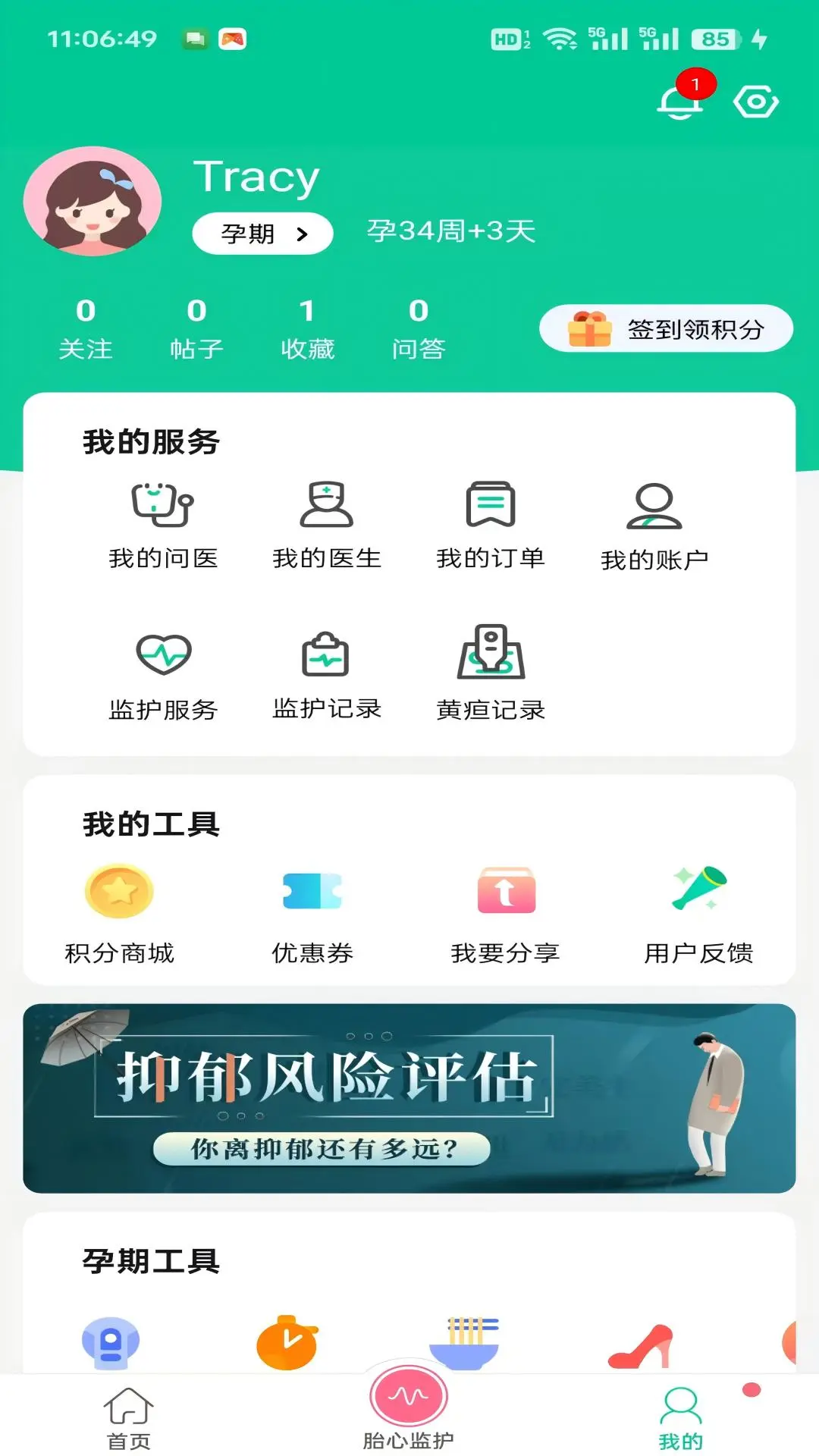 微胎心截图